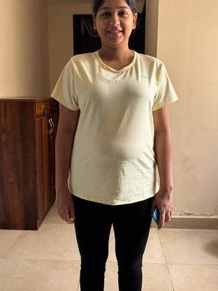 Before — a client of Pavan gowdaP