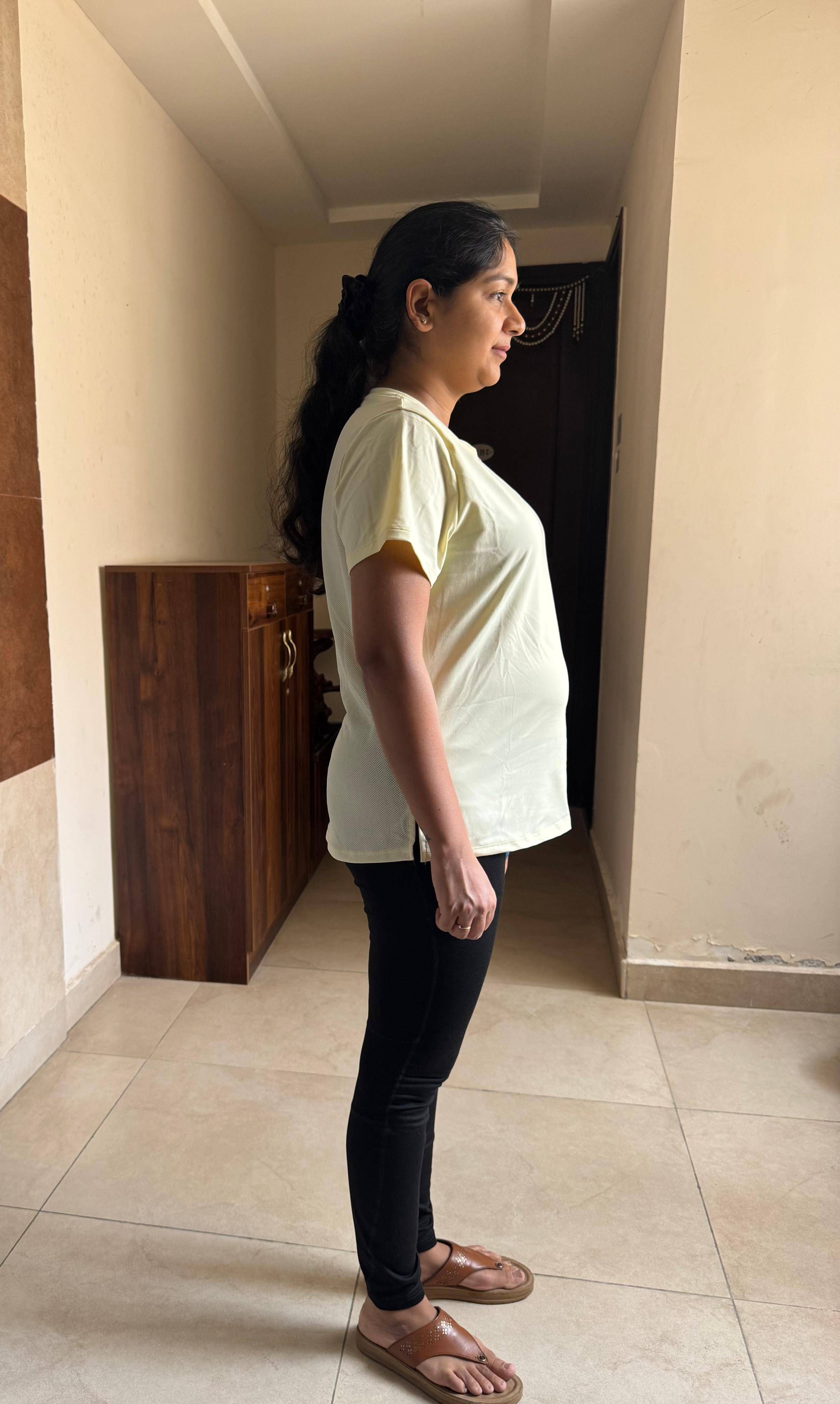 Before — a client of Pavan gowdaP