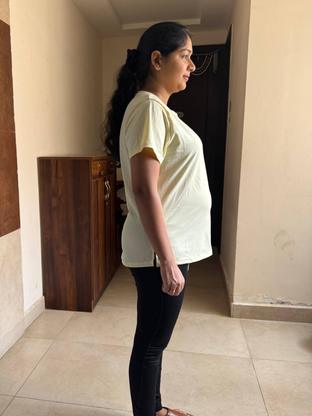 Before — a client of Pavan gowdaP