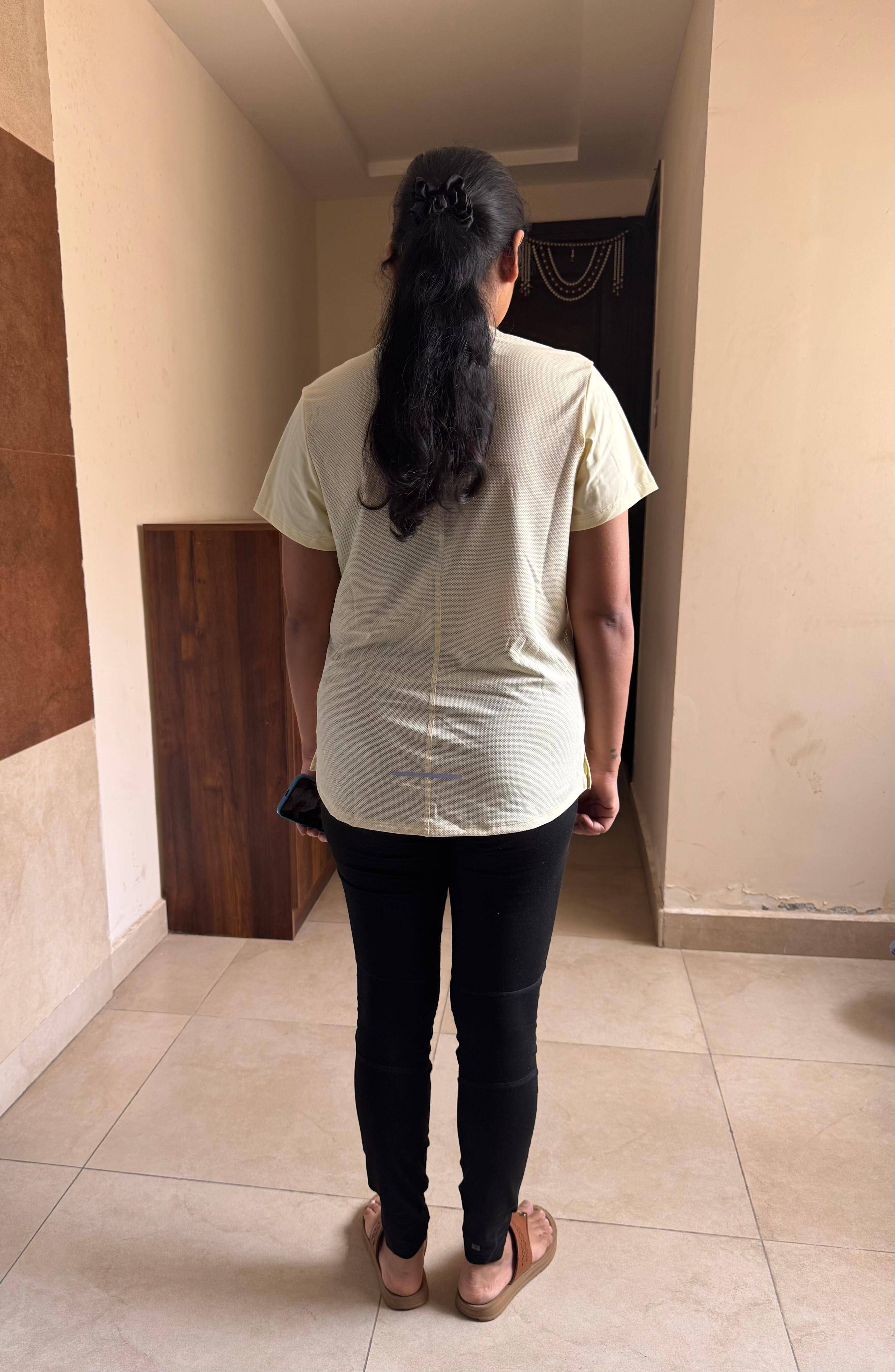 Before — a client of Pavan gowdaP