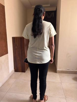 Before — a client of Pavan gowdaP