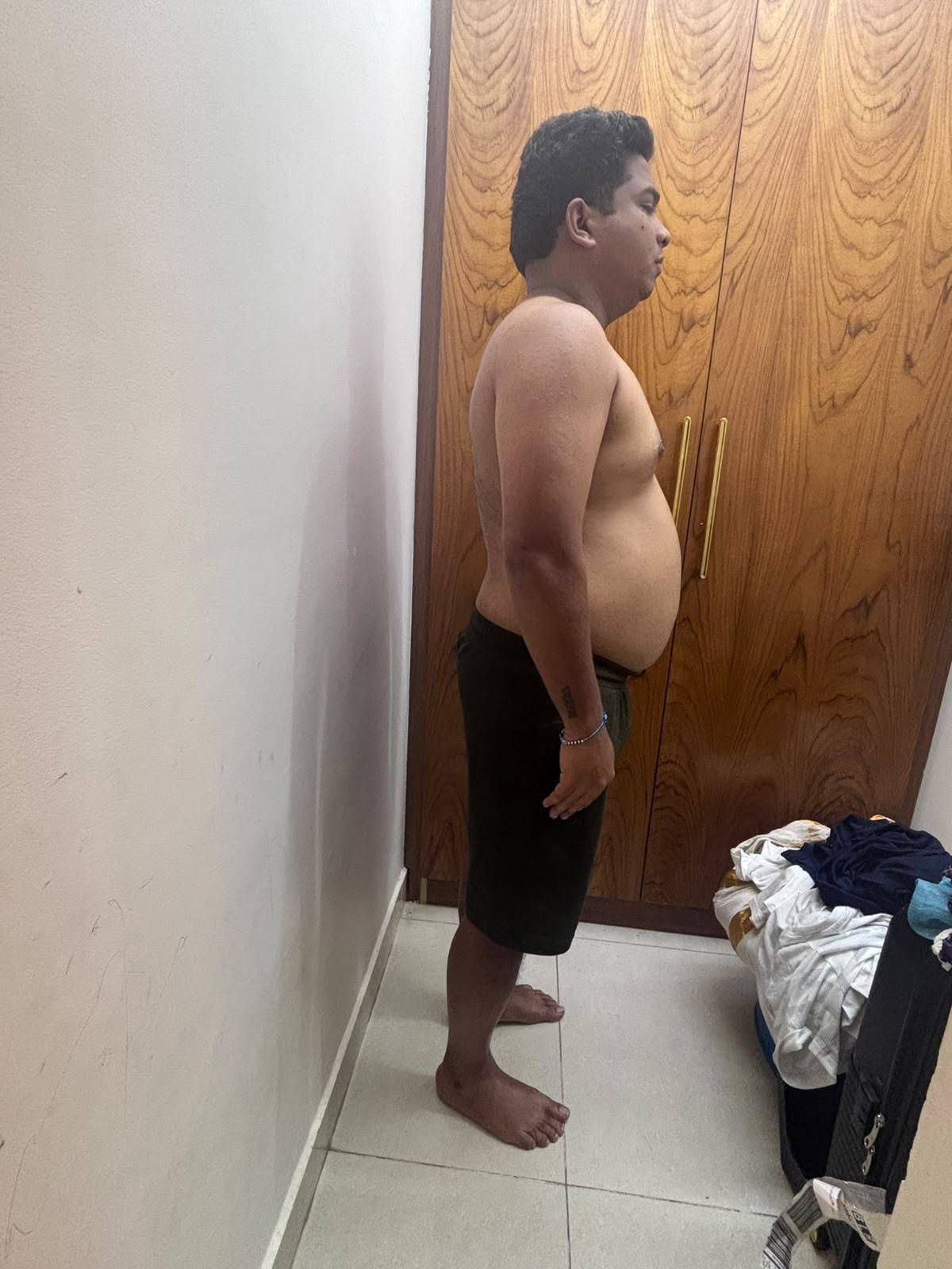 Before — a client of Pavan gowdaP