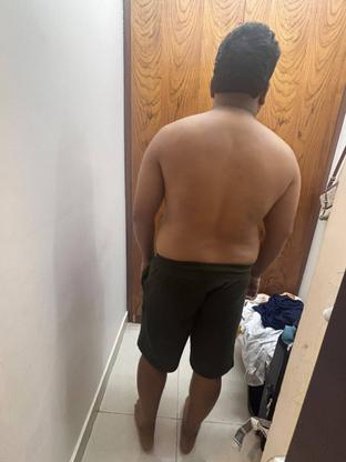 Before — a client of Pavan gowdaP