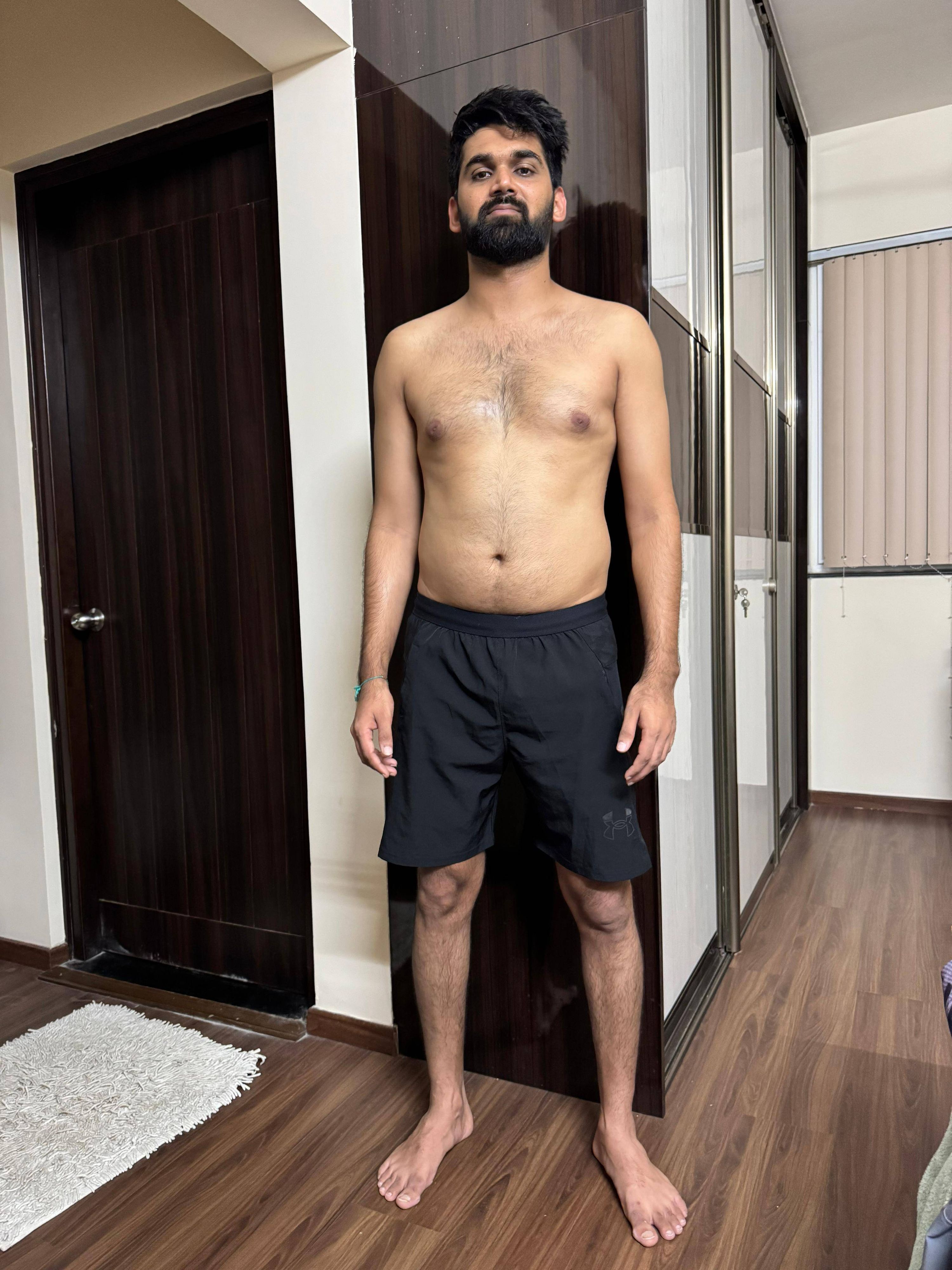 Before — a client of Pavan gowdaP