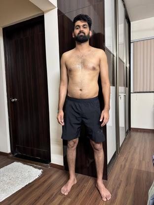 Before — a client of Pavan gowdaP