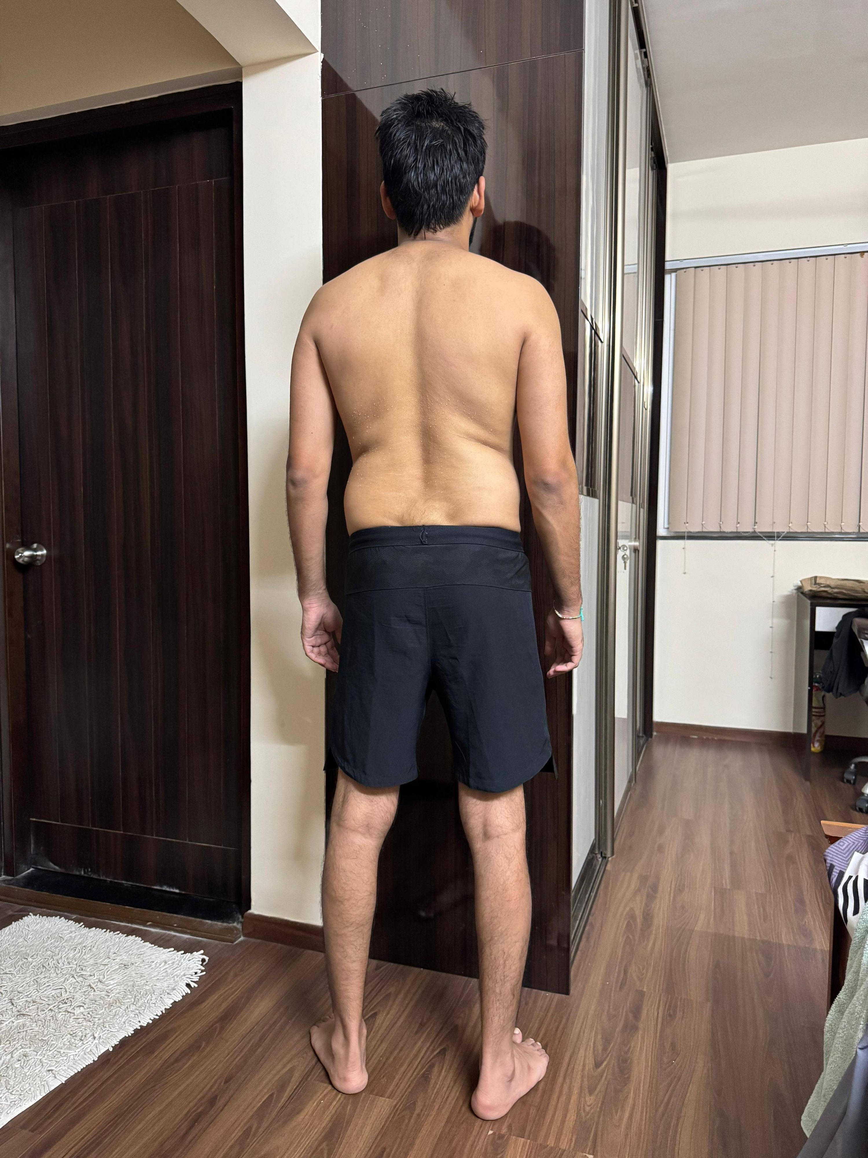 Before — a client of Pavan gowdaP
